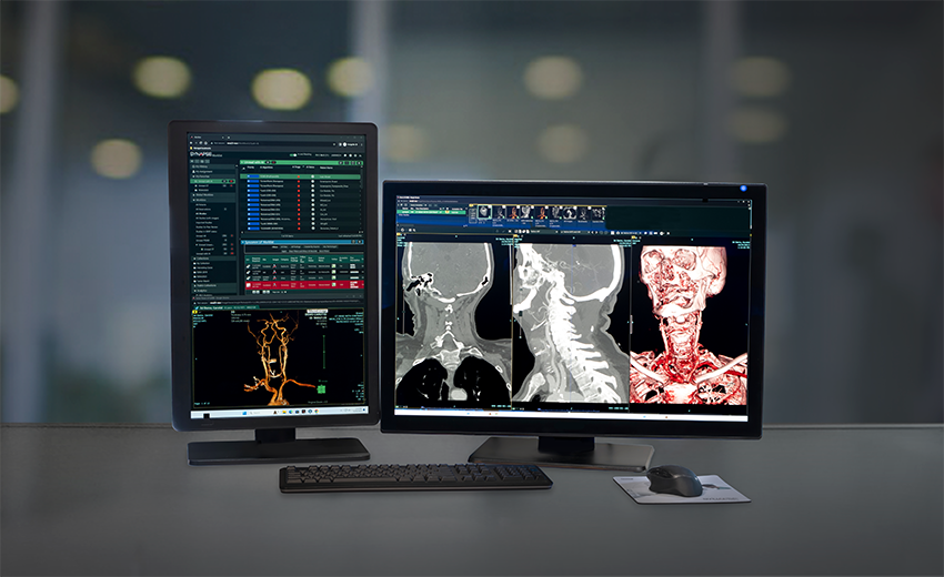 Dual-monitor PACS workstation displaying radiology scans and diagnostic imaging results.